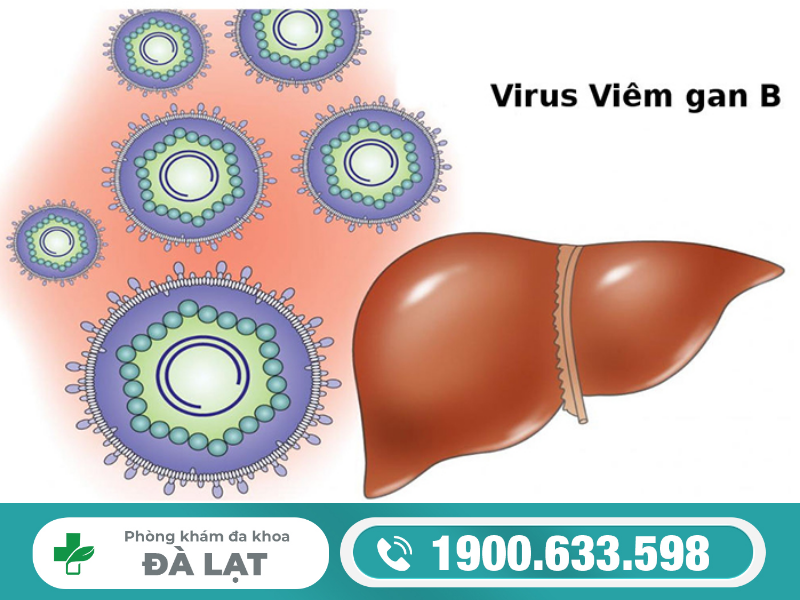 Hình ảnh minh họa